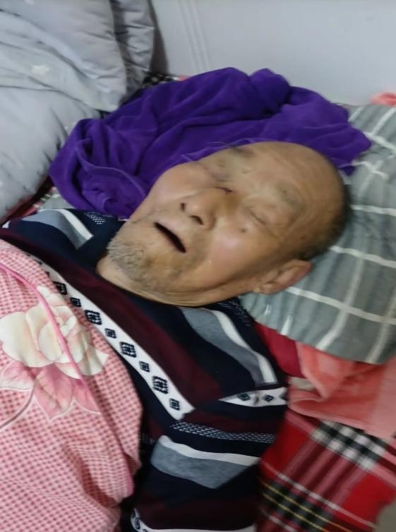 一个脑梗患者在中西医治疗过程的思考