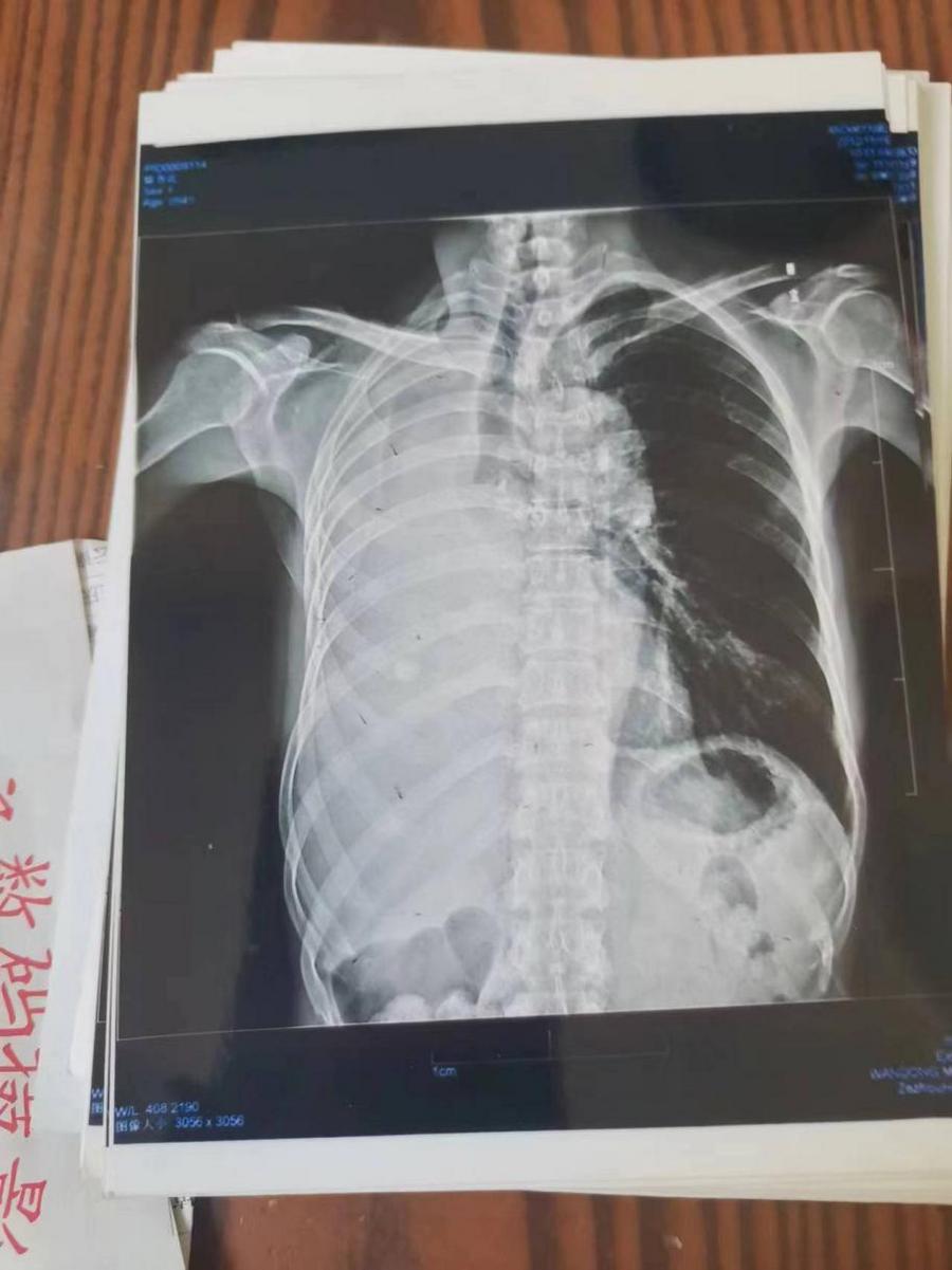 238beeb5766e91438e15f3e12d08c92