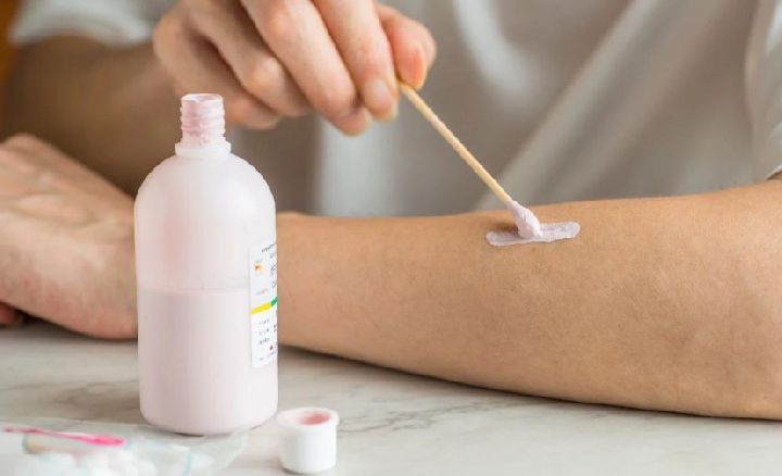 这种皮肤科“神药”真的被夸大了，很多人还在乱用！快自查！