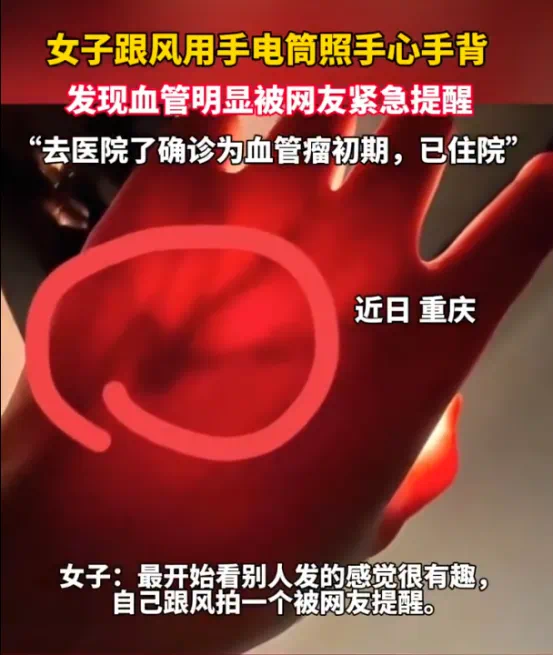 一张照片竟被网友看出血管瘤 身体出现这3个信号要当心